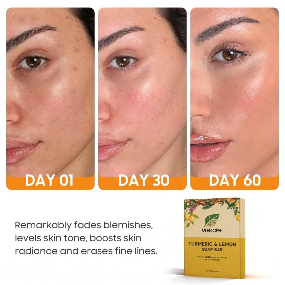 Lemon & Turmeric Glow Soap Bar for Dark Spots Remover, Powered by Kojic Acid